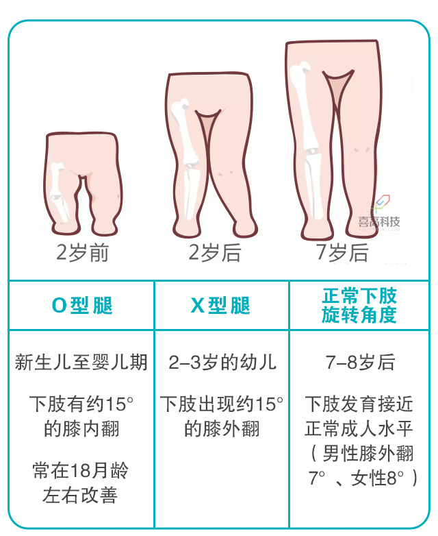 寶寶身長腿短，長大會是矮個(gè)子嗎？_03.gif