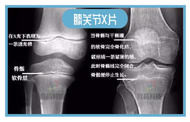 默認(rèn)標(biāo)題_自定義cm_2019-11-22-0.jpg